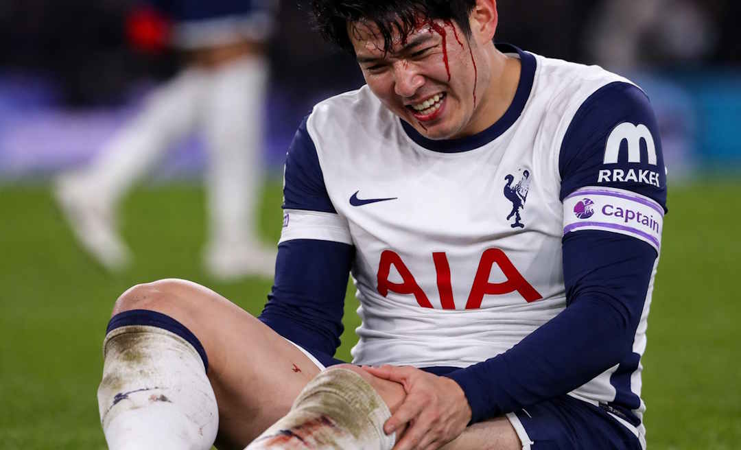 injured soccer players - voided bets